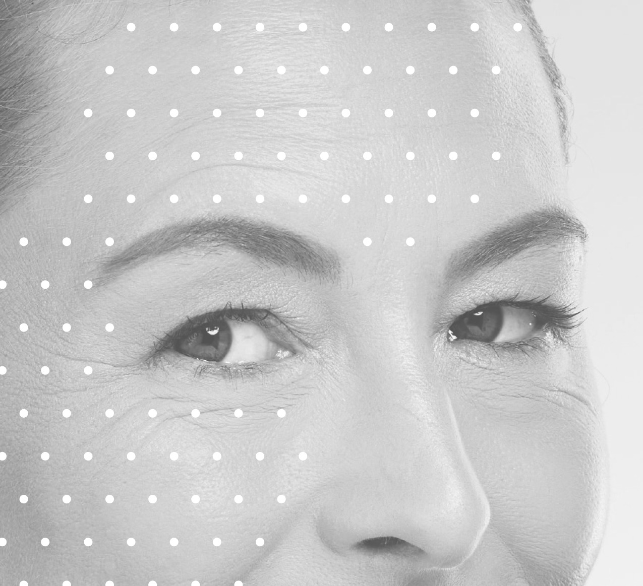 lier_microneedling·gs