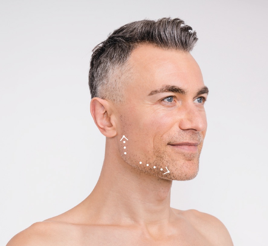 lier_profilaufbau_mit_implantaten·3c