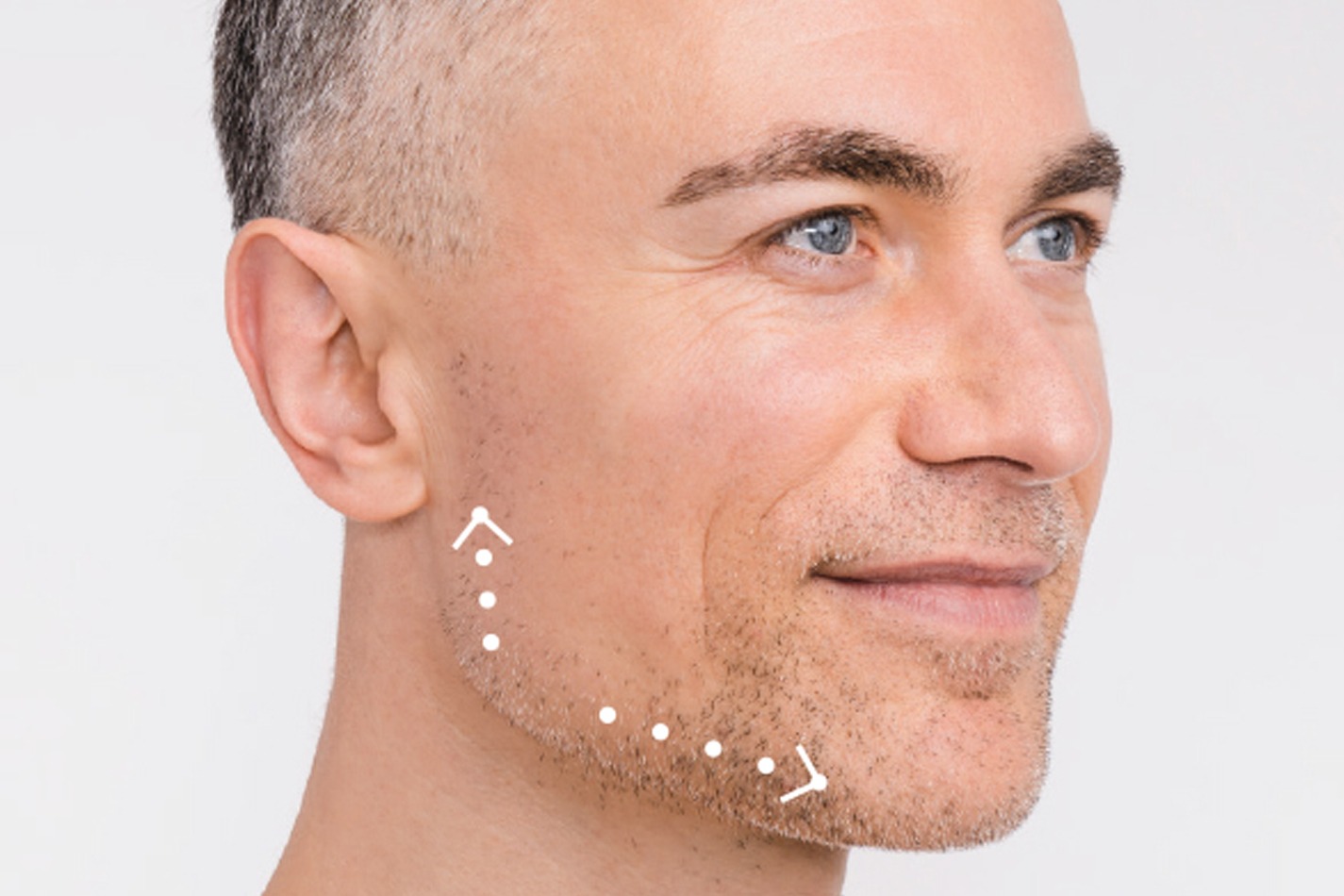 lier_profilaufbau_mit_implantaten·3c_mobil